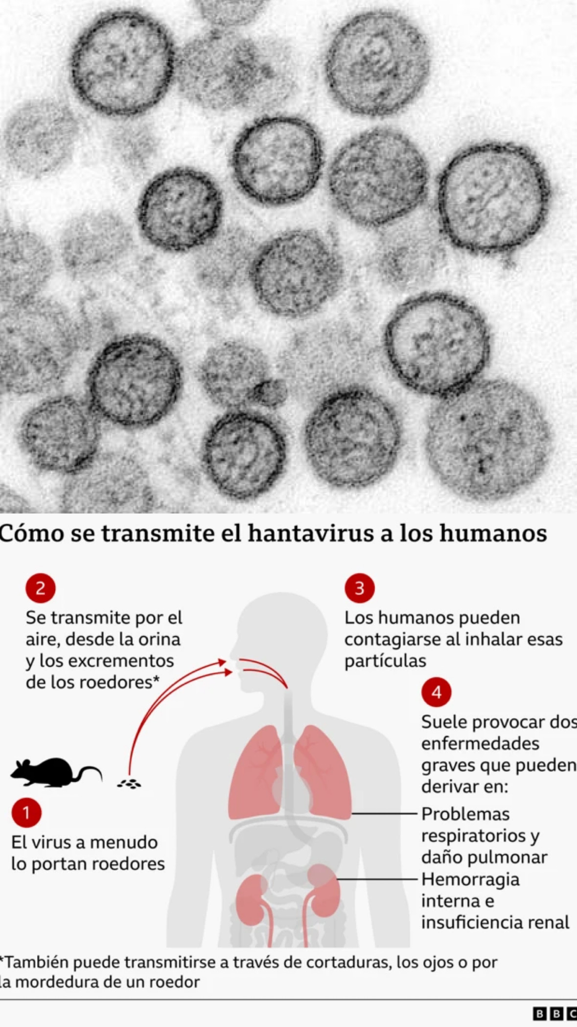 Hantavirus: el brote internacional que mantiene bajo alerta sanitaria a varios países